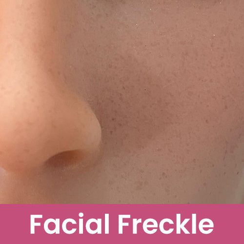 Fanreal | Facial Freckle Upgrade (Not to Be Sold Without Sex Doll)