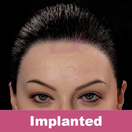 Zelex | Implanted Synthetic Hair (Not to Be Sold Without Sex Doll)